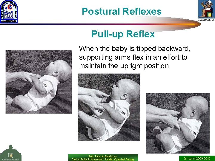 Postural Reflexes Pull-up Reflex When the baby is tipped backward, supporting arms flex in