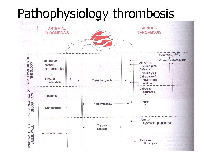 Pathophysiology thrombosis 