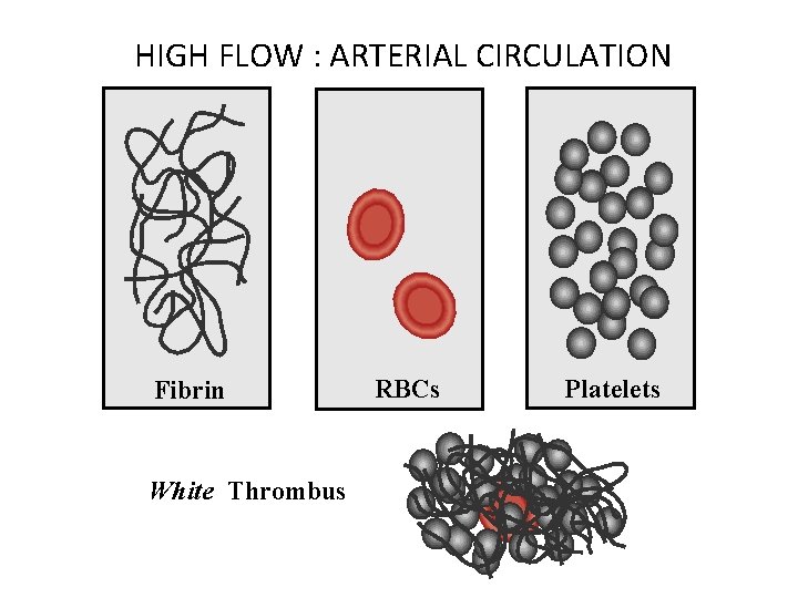 HIGH FLOW : ARTERIAL CIRCULATION Fibrin White Thrombus RBCs Platelets 