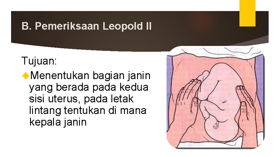 B. Pemeriksaan Leopold II Tujuan: Menentukan bagian janin yang berada pada kedua sisi uterus, B. Pemeriksaan Leopold II Tujuan: Menentukan bagian janin yang berada pada kedua sisi uterus,