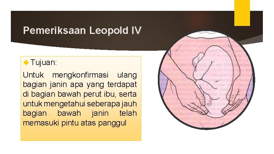 Pemeriksaan Leopold IV Tujuan: Untuk mengkonfirmasi ulang bagian janin apa yang terdapat di bagian Pemeriksaan Leopold IV Tujuan: Untuk mengkonfirmasi ulang bagian janin apa yang terdapat di bagian