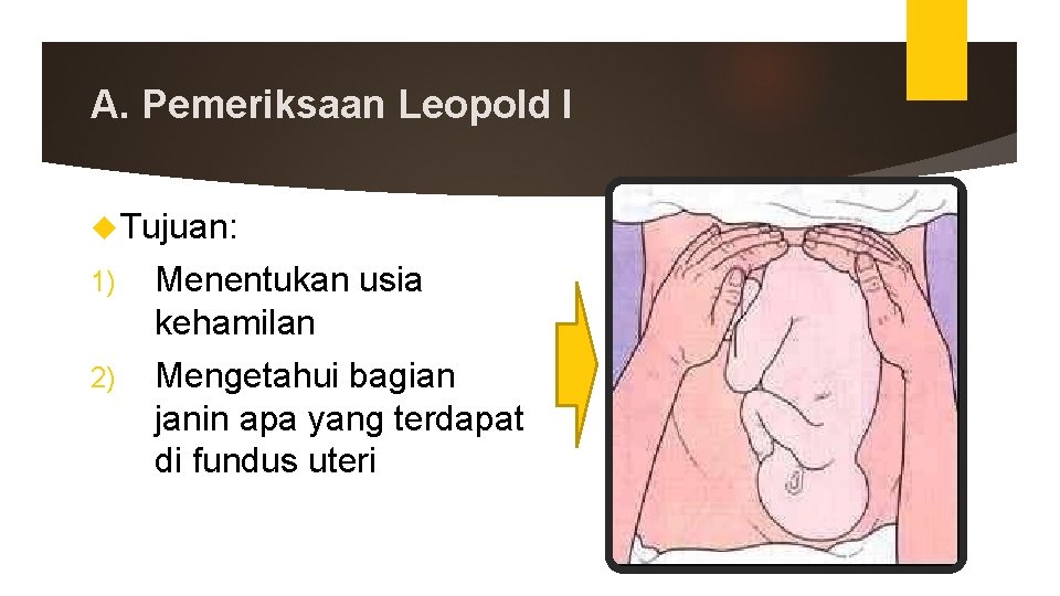 A. Pemeriksaan Leopold I Tujuan: 1) Menentukan usia kehamilan 2) Mengetahui bagian janin apa A. Pemeriksaan Leopold I Tujuan: 1) Menentukan usia kehamilan 2) Mengetahui bagian janin apa
