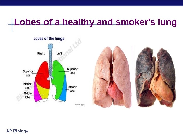 Lobes of a healthy and smoker's lung Your text here AP Biology 