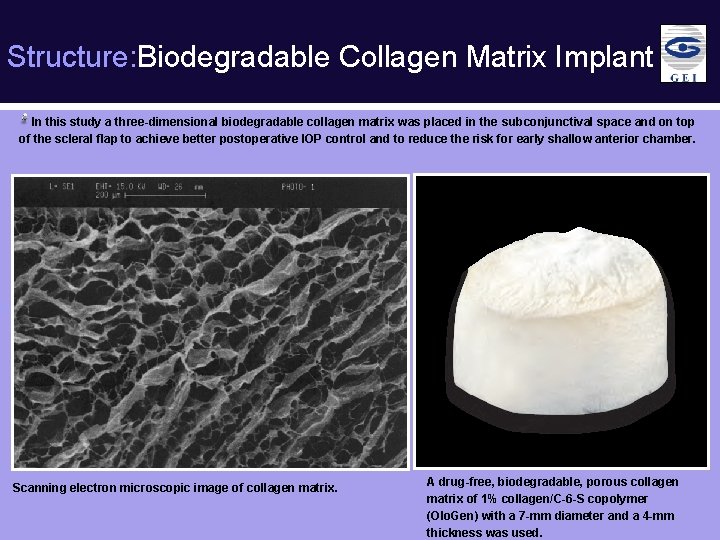 Structure: Biodegradable Collagen Matrix Implant In this study a three-dimensional biodegradable collagen matrix was