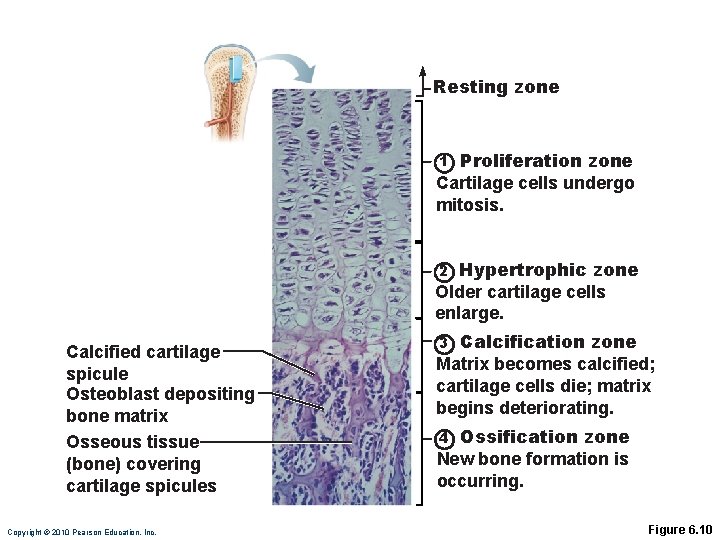 Resting zone Proliferation zone Cartilage cells undergo mitosis. 1 Hypertrophic zone Older cartilage cells