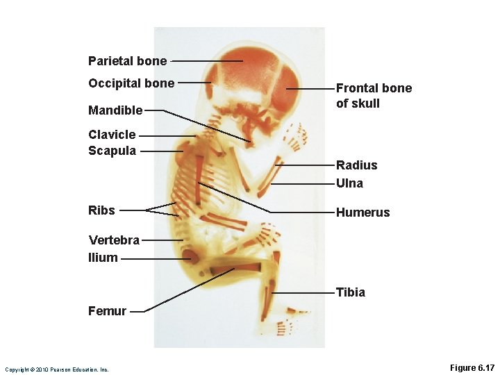 Parietal bone Occipital bone Mandible Frontal bone of skull Clavicle Scapula Radius Ulna Ribs