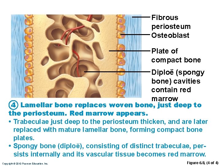 Fibrous periosteum Osteoblast Plate of compact bone Diploë (spongy bone) cavities contain red marrow