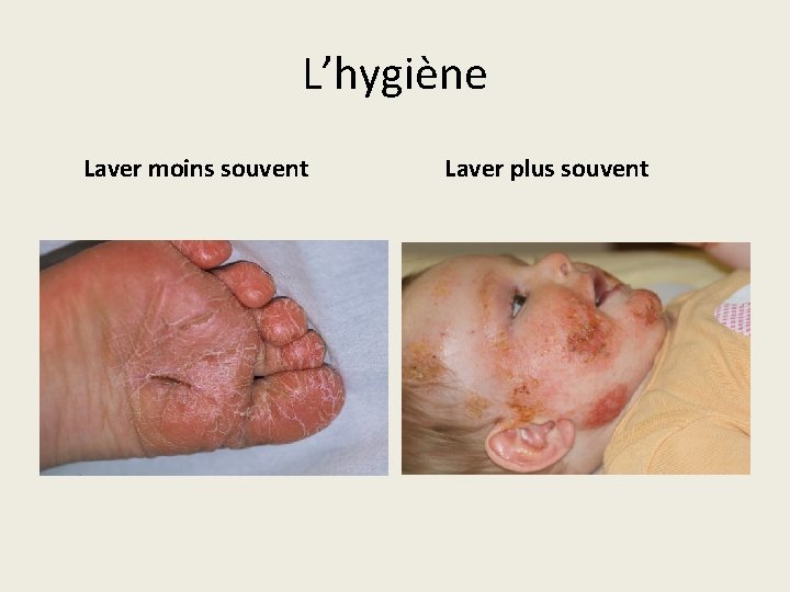 L’hygiène Laver moins souvent Laver plus souvent 