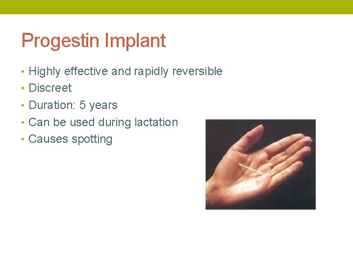Progestin Implant • Highly effective and rapidly reversible • Discreet • Duration: 5 years