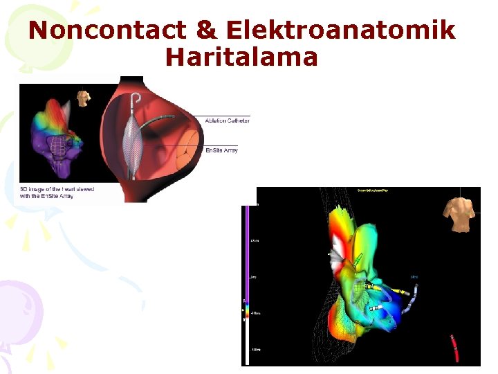 Noncontact & Elektroanatomik Haritalama 