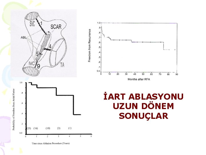 İART ABLASYONU UZUN DÖNEM SONUÇLAR 