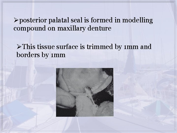 Øposterior palatal seal is formed in modelling compound on maxillary denture ØThis tissue surface