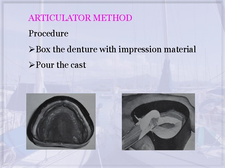 ARTICULATOR METHOD Procedure ØBox the denture with impression material ØPour the cast 