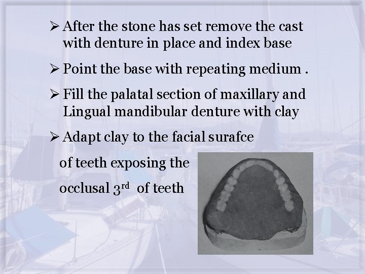 Ø After the stone has set remove the cast with denture in place and