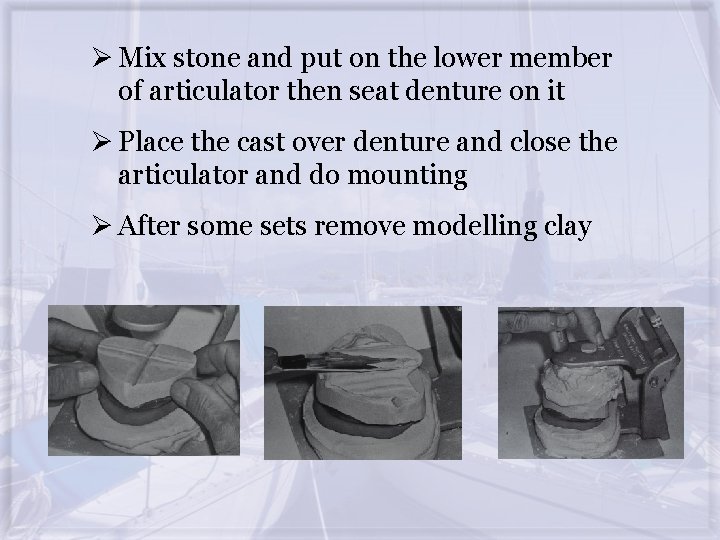 Ø Mix stone and put on the lower member of articulator then seat denture