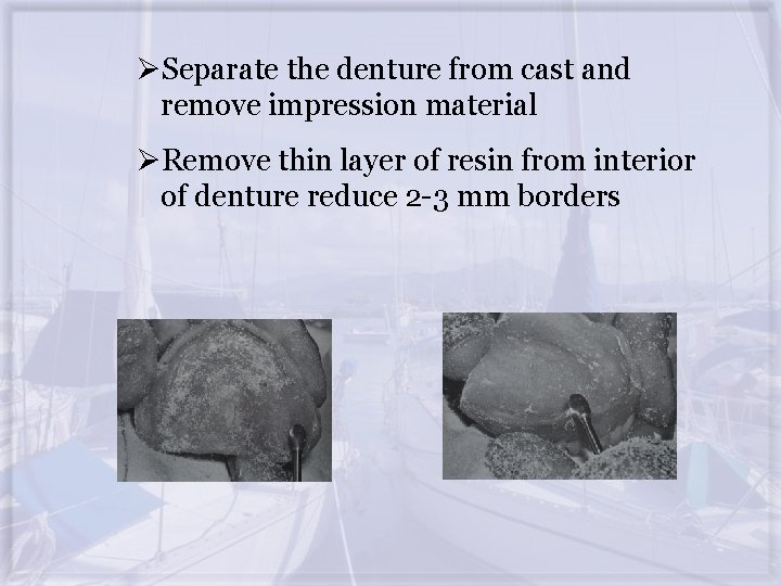 ØSeparate the denture from cast and remove impression material ØRemove thin layer of resin