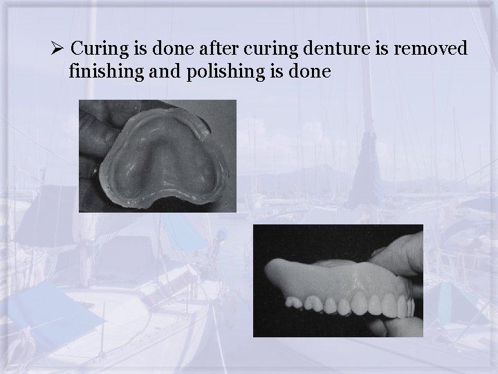 Ø Curing is done after curing denture is removed finishing and polishing is done