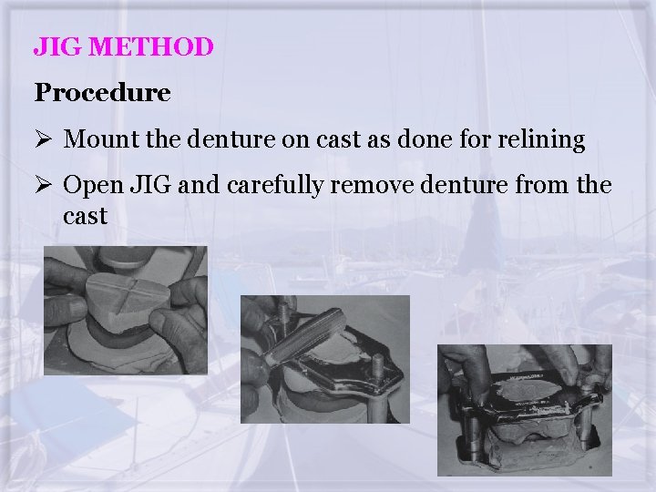 JIG METHOD Procedure Ø Mount the denture on cast as done for relining Ø