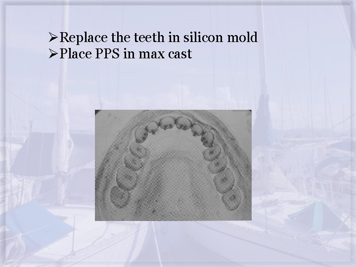 ØReplace the teeth in silicon mold ØPlace PPS in max cast 