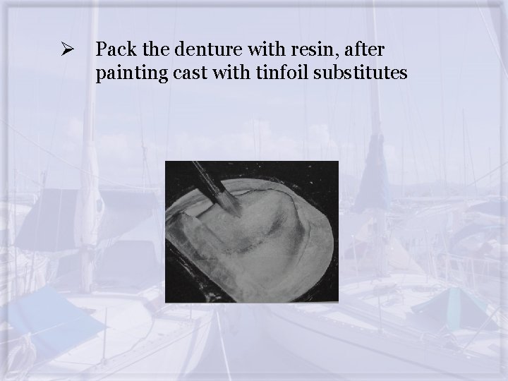 Ø Pack the denture with resin, after painting cast with tinfoil substitutes 