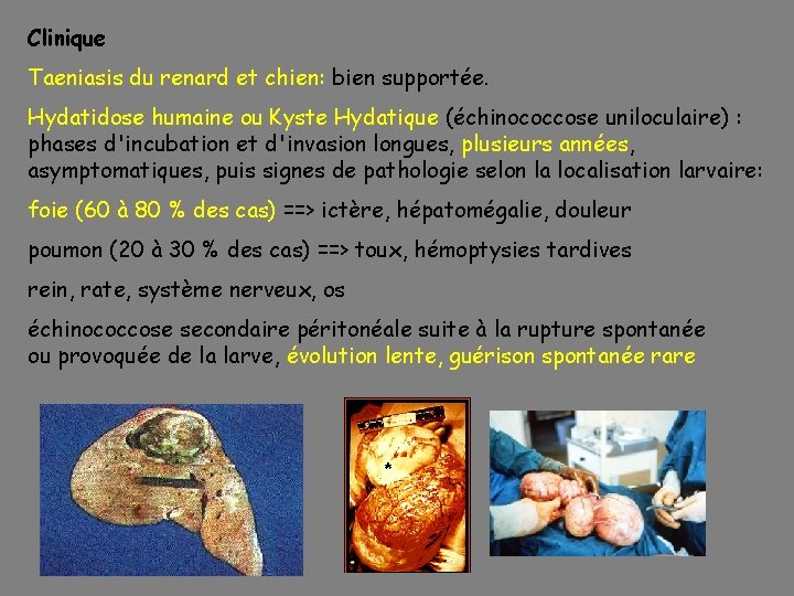 Clinique Taeniasis du renard et chien: bien supportée. Hydatidose humaine ou Kyste Hydatique (échinococcose