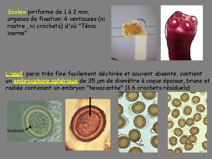 Scolex piriforme de 1 à 2 mm, organes de fixation: 4 ventouses (ni rostre