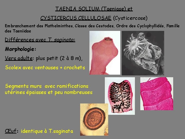 TAENIA SOLIUM (Taeniase) et CYSTICERCUS CELLULOSAE (Cysticercose) Embranchement des Plathelminthes, Classe des Cestodes, Ordre