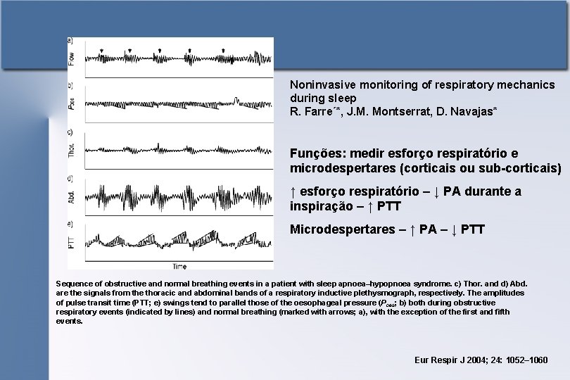 Noninvasive monitoring of respiratory mechanics during sleep R. Farre´*, J. M. Montserrat, D. Navajas*
