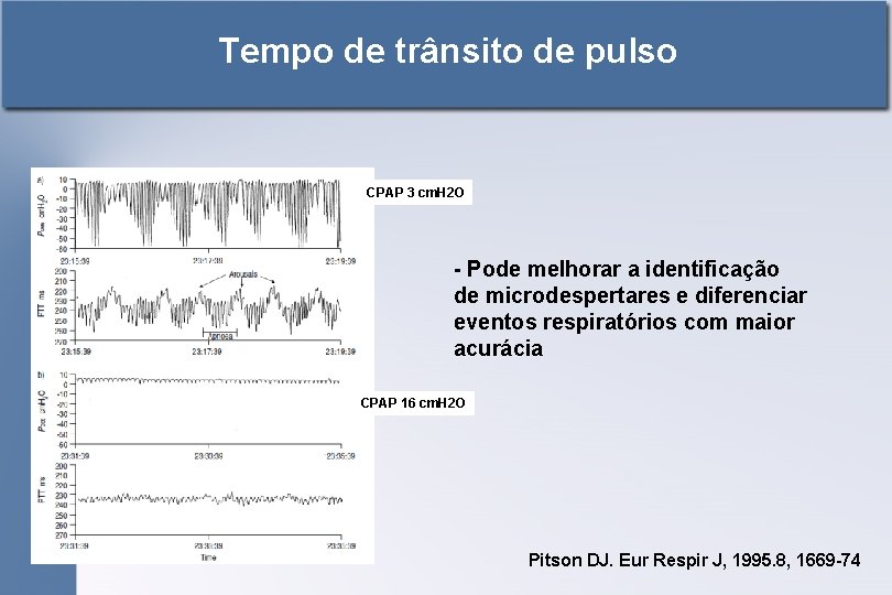 Tempo de trânsito de pulso CPAP 3 cm. H 2 O - Pode melhorar