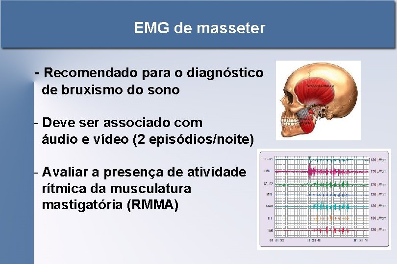 EMG de masseter - Recomendado para o diagnóstico de bruxismo do sono - Deve