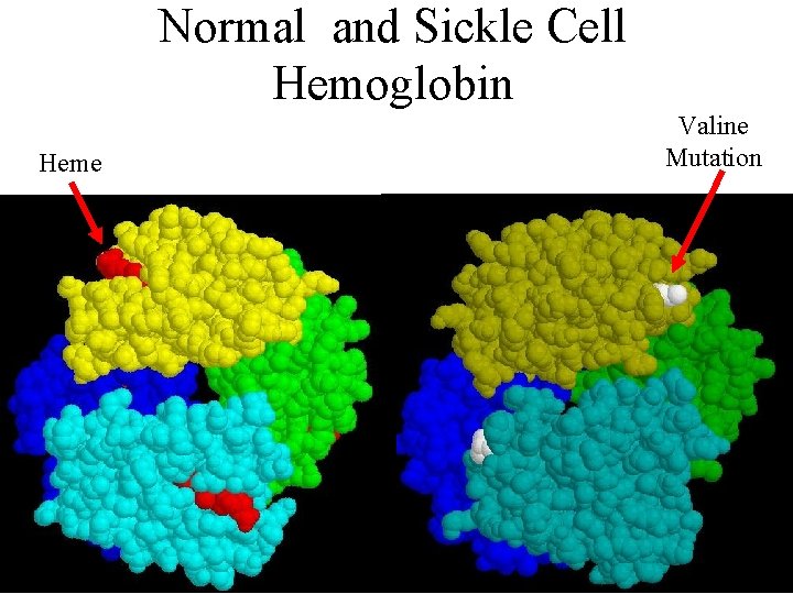 Normal and Sickle Cell Hemoglobin Heme Valine Mutation 