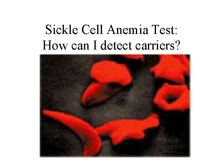 Sickle Cell Anemia Test: How can I detect carriers? 