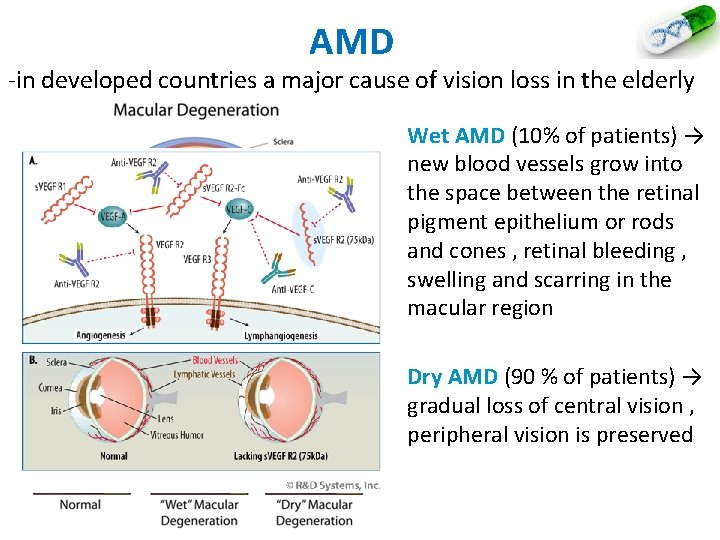 AMD -in developed countries a major cause of vision loss in the elderly Wet