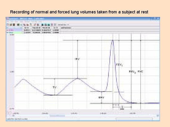 Recording of normal and forced lung volumes taken from a subject at rest 