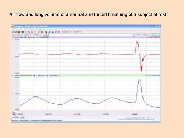 Air flow and lung volume of a normal and forced breathing of a subject