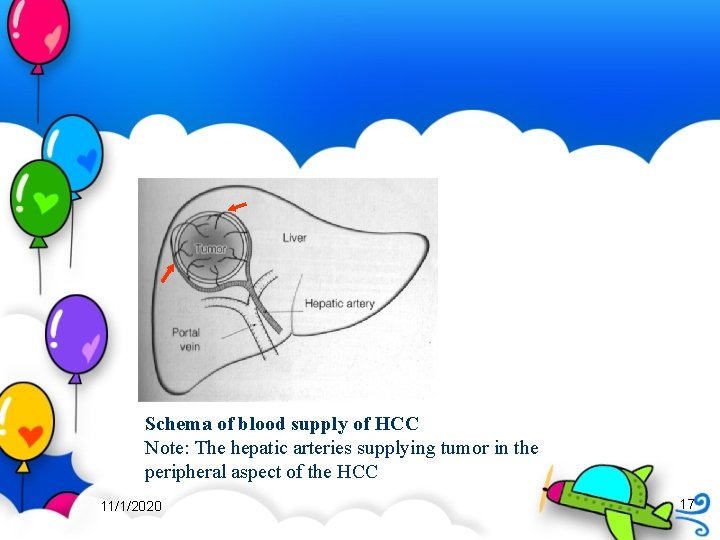 Schema of blood supply of HCC Note: The hepatic arteries supplying tumor in the