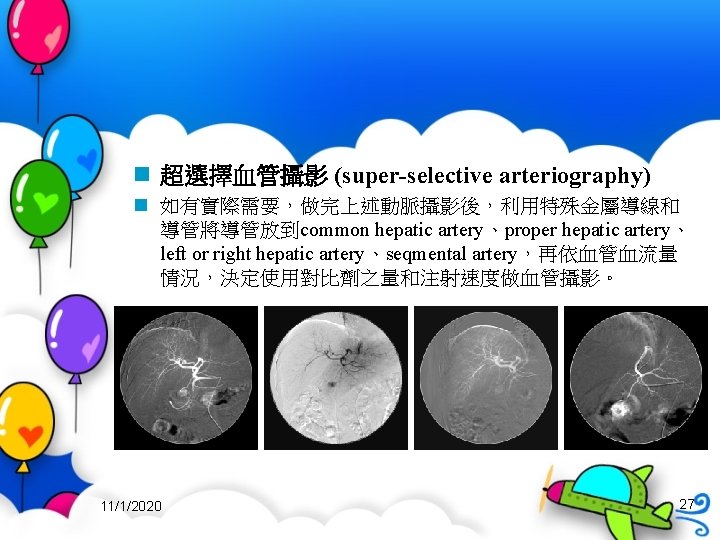 n 超選擇血管攝影 (super-selective arteriography) n 如有實際需要，做完上述動脈攝影後，利用特殊金屬導線和 導管將導管放到common hepatic artery、proper hepatic artery、 left or right