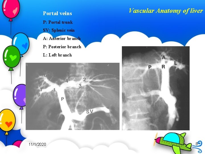 Portal veins Vascular Anatomy of liver P: Portal trunk SV: Splenic vein A: Anterior