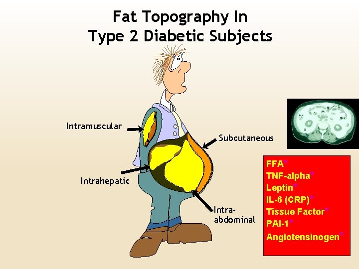 Fat Topography In Type 2 Diabetic Subjects Intramuscular Subcutaneous Intrahepatic Intraabdominal FFA* TNF-alpha* Leptin*