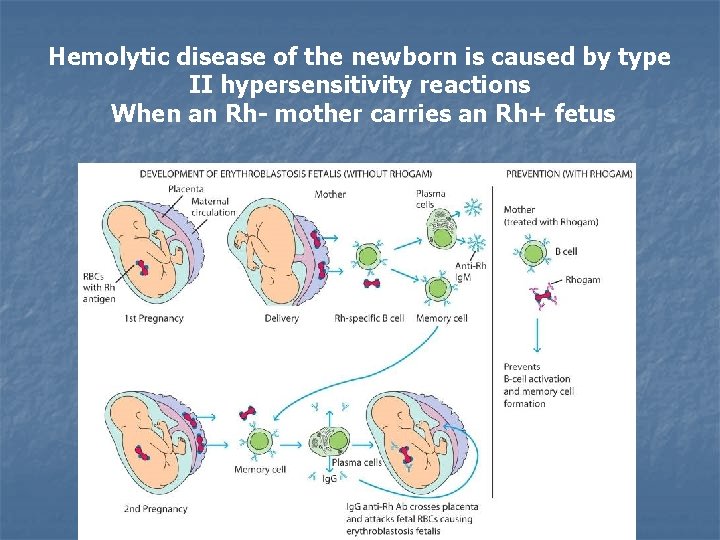 Hemolytic disease of the newborn is caused by type II hypersensitivity reactions When an
