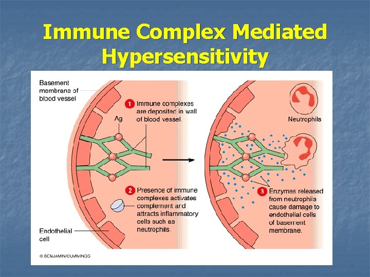 Immune Complex Mediated Hypersensitivity 
