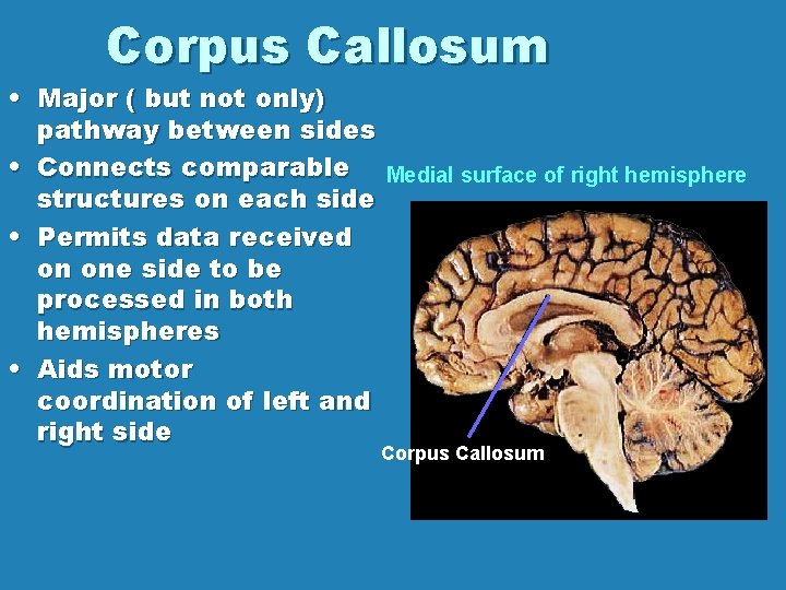 Corpus Callosum • Major ( but not only) pathway between sides • Connects comparable