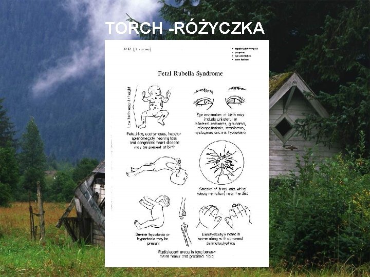 TORCH -RÓŻYCZKA 