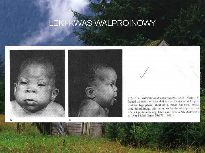 LEKI-KWAS WALPROINOWY 