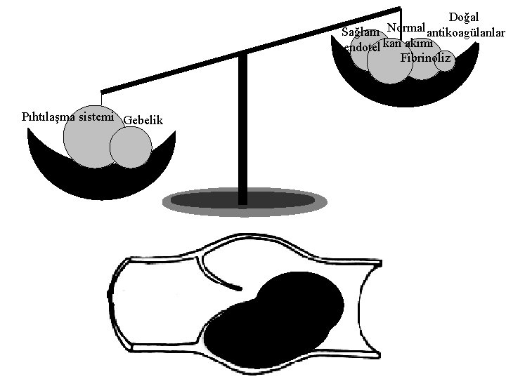 Doğal Sağlam Normal antikoagülanlar endotel kan akımı Fibrinoliz Pıhtılaşma sistemi Gebelik 