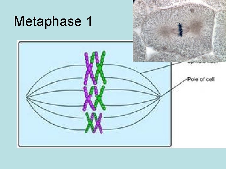 Metaphase 1 