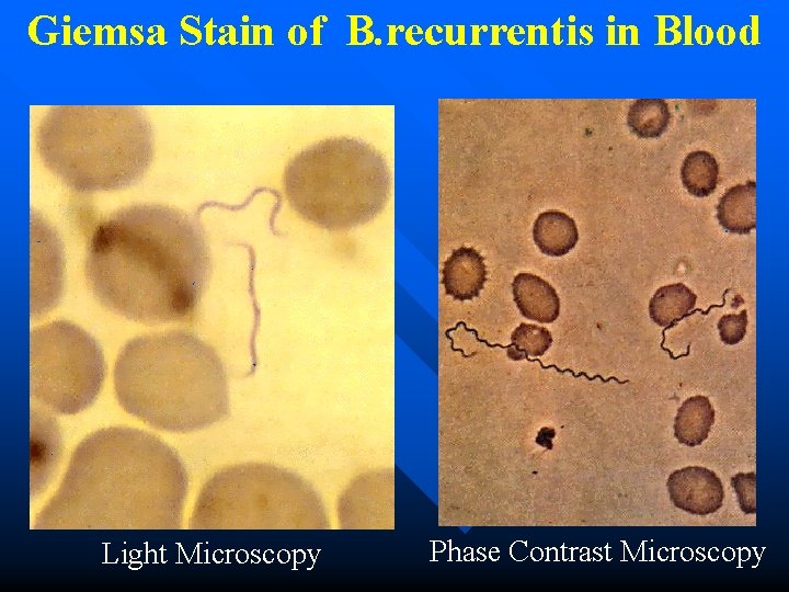 Giemsa Stain of B. recurrentis in Blood Light Microscopy Phase Contrast Microscopy 