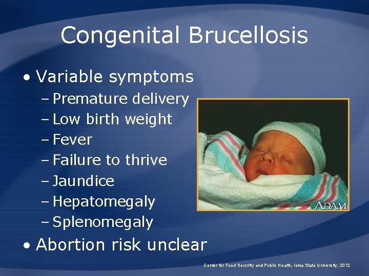 Congenital Brucellosis • Variable symptoms – Premature delivery – Low birth weight – Fever