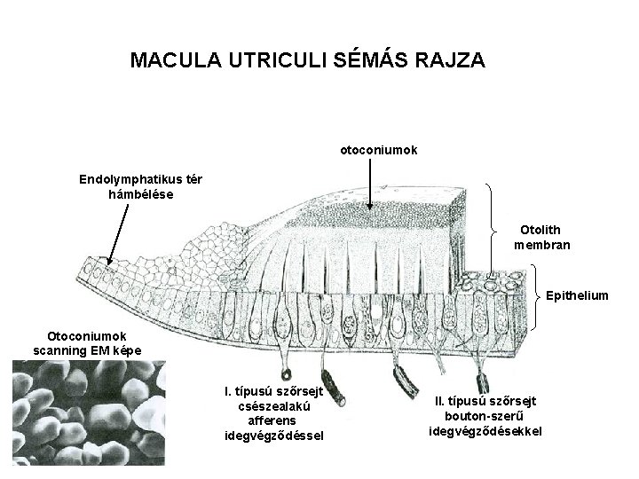 MACULA UTRICULI SÉMÁS RAJZA otoconiumok Endolymphatikus tér hámbélése Otolith membran Epithelium Otoconiumok scanning EM