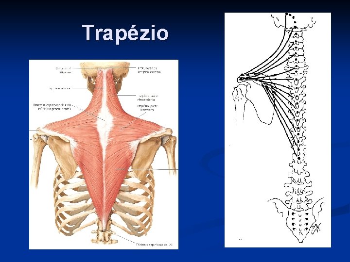 Trapézio 